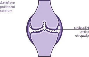 Ostestováno: CONDROSULF POR 400MG CPS DUR 180(3X60)